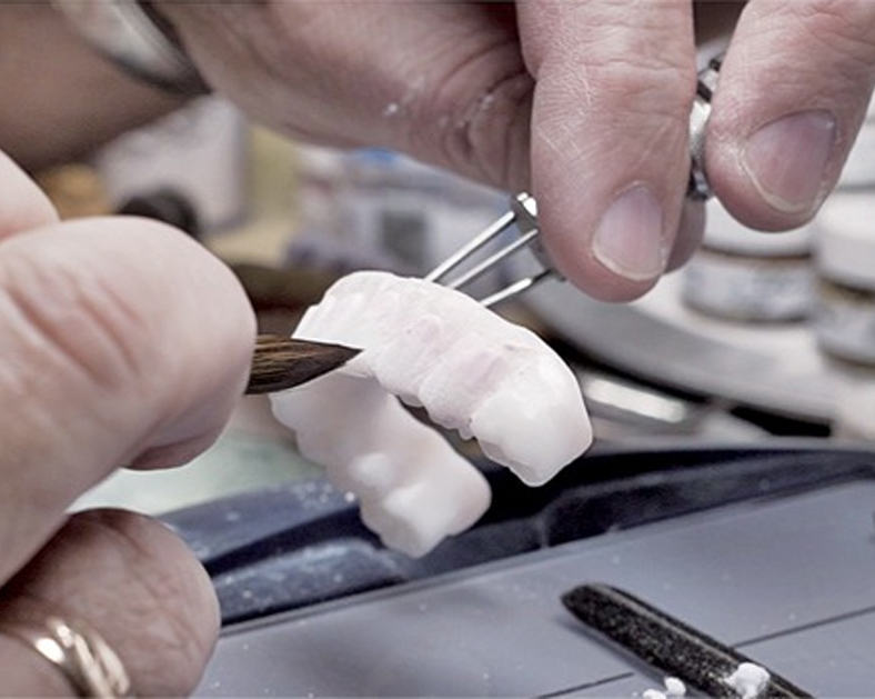 All on 4 Dental Implant Lab - OneSolution