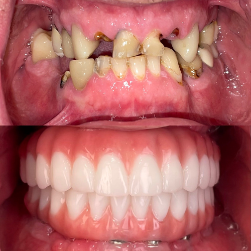 Before and After Patient - OneSolution