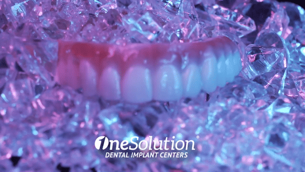 All on 4 Dental Implant Zyrconia Teeth - OneSolution® Dental Implants