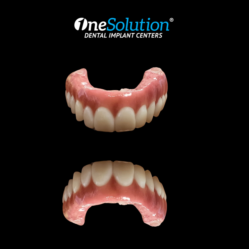 Dental Implants