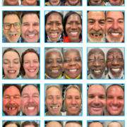 OneSolution® Dental Implants Types