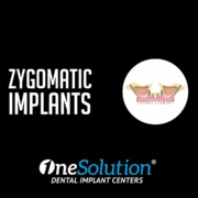 Zygomatic Impants - OneSolution® Dental Implants Centers
