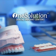 Full Mouth Dental Implants - All on 4 Dental Implants - OneSolution