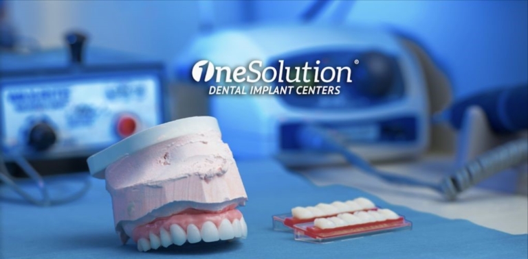 Dental Implants Florida's #1 Center: OneSolution®️ Dental Implants