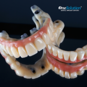 Dental Implants Near in South Florida - OneSolution
