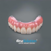 OneSolution® Dental Implants - Best Dental Implants Near