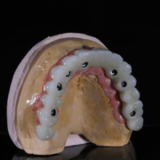 all on x dental implants with a full arch going across the teeth