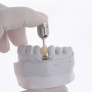 a single dental implant with a doctor holding up the tool piece to show how its place on a model