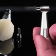 a single dental implant with a doctor holding up a tool to place it onto the jaw
