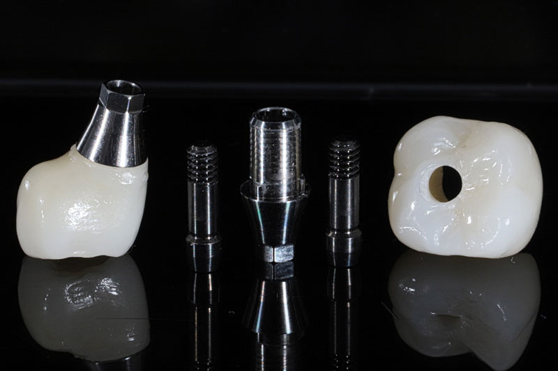 a single dental implant from start to finish with the crown implant and abutment