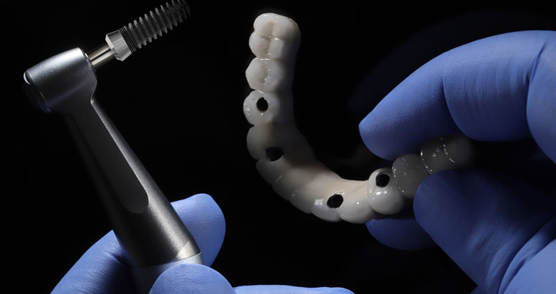 a full arch of teeth with a tool to place it onto the mouth