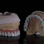 2 full arches of teeth with jaw models placed underneath