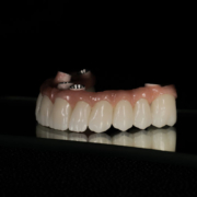 a full arch of zirconia teeth with holes for implants to be placed
