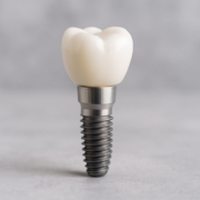 a single dental implant with a crown on top of it