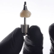 a single dental implant with a dentist holding up a drill attachment