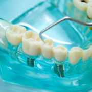 a single dental implant with another beside it and a dentist holding a tool