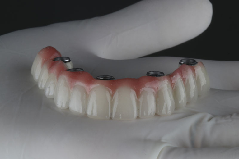 Dental Implants Florida's #1 Center: OneSolution®️ Dental Implants