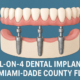 all on 4 dental implants
